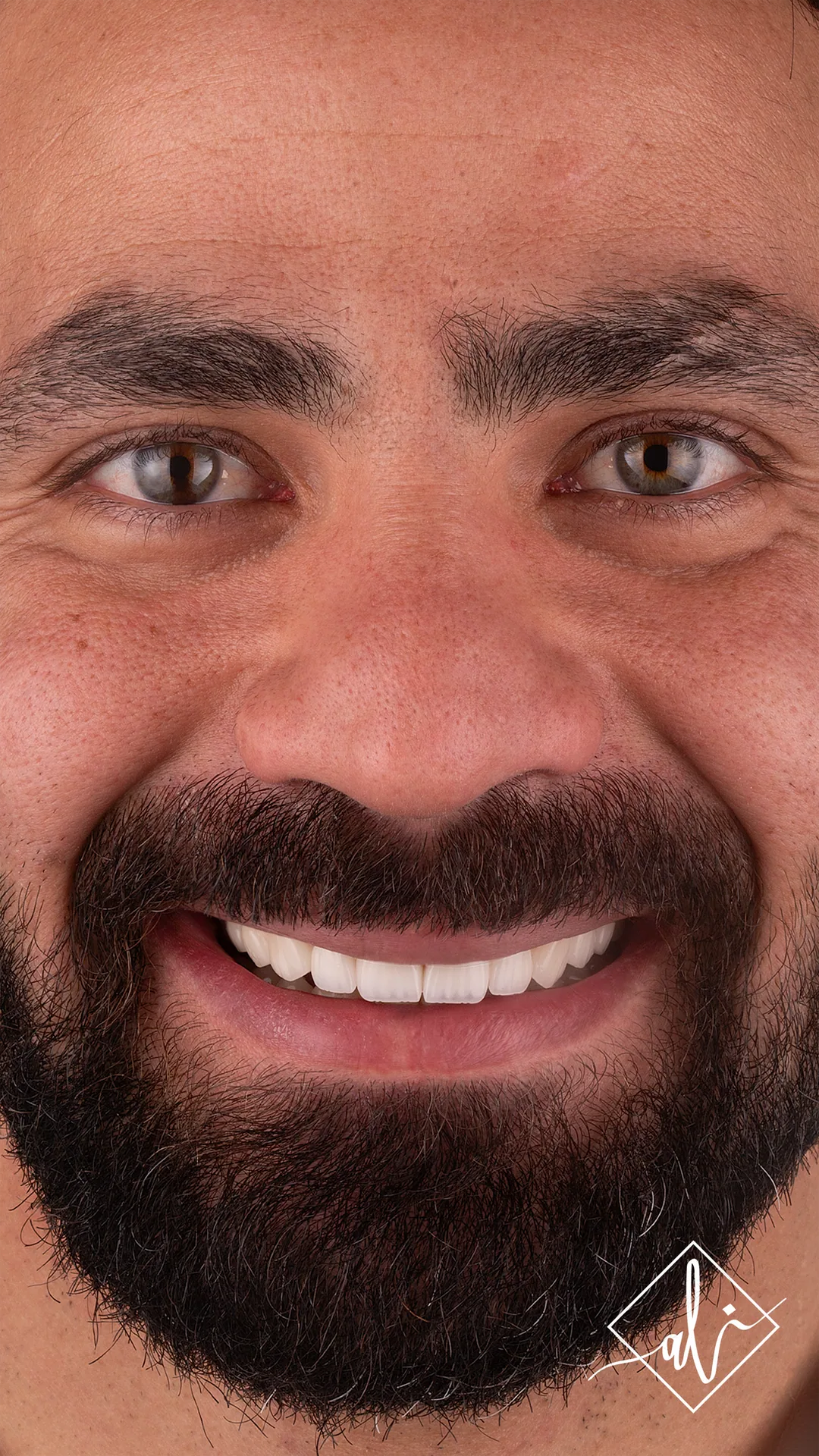 Dental smile design transformation by Dr. Ali Al Heneiti