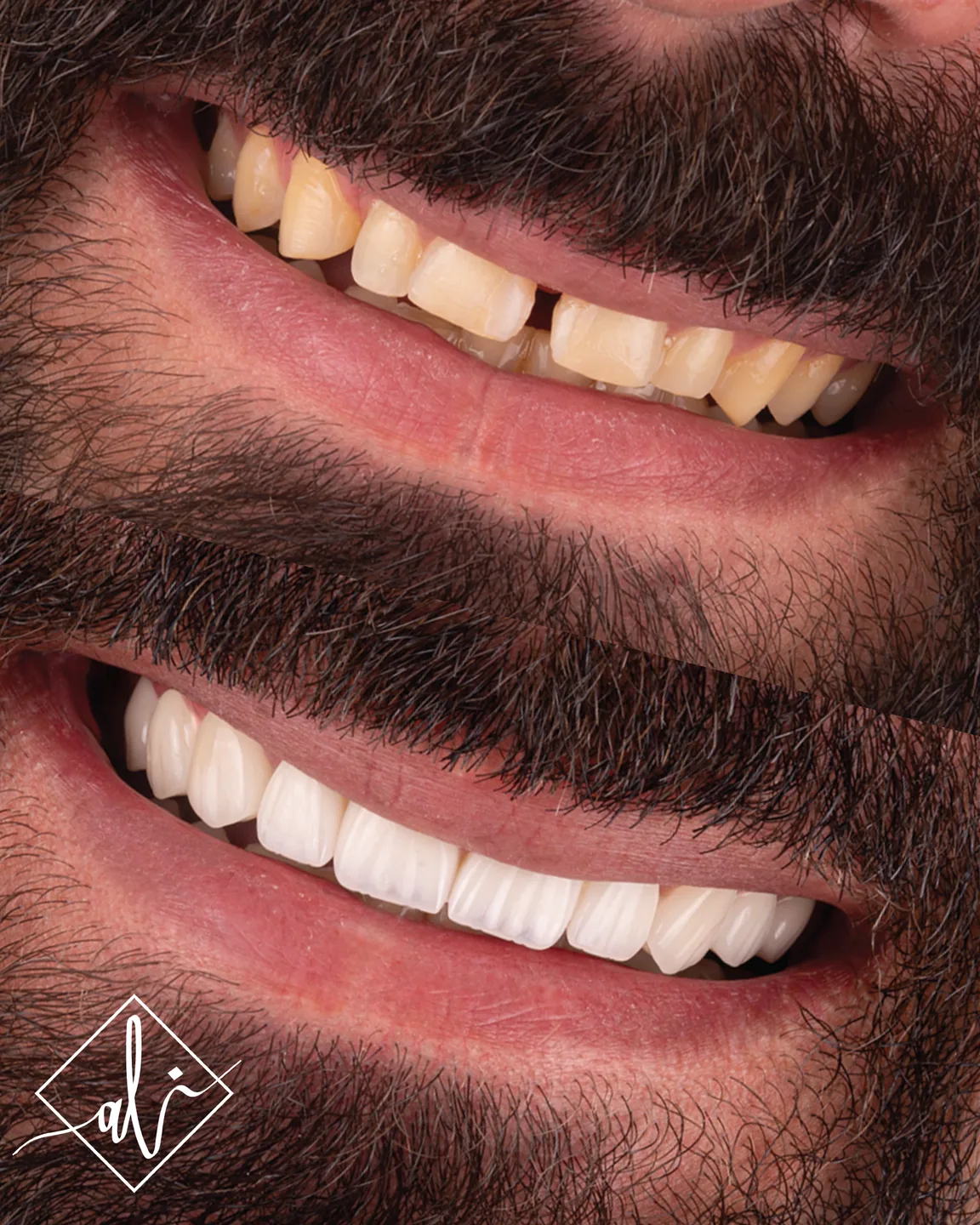 Dental smile design transformation by Dr. Ali Al Heneiti 7